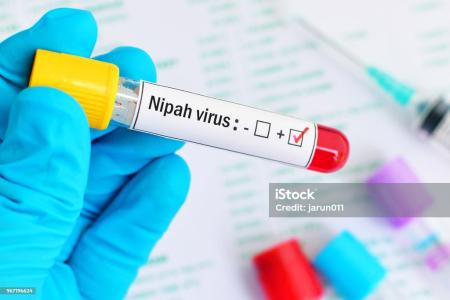 Apa itu Virus Nipah? Waspada dan Kurangi Risiko Penularannya dengan  Langkah Ini! 